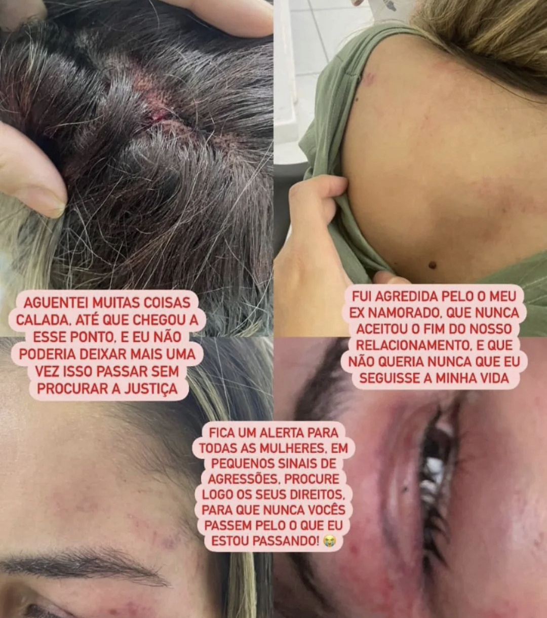 COMDIM-CN emite nota de repúdio e pede justiça em caso de violência contra mulher em Currais Novos