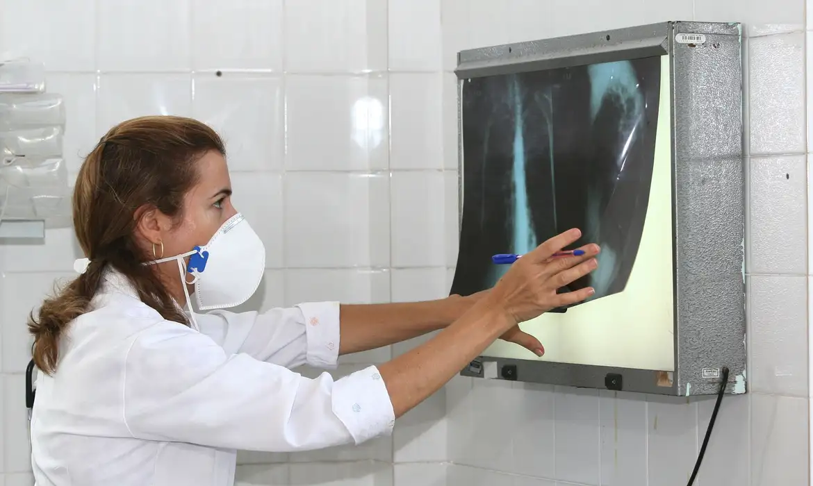 OMS recomenda testes de diagnóstico rápido para erradicar tuberculose