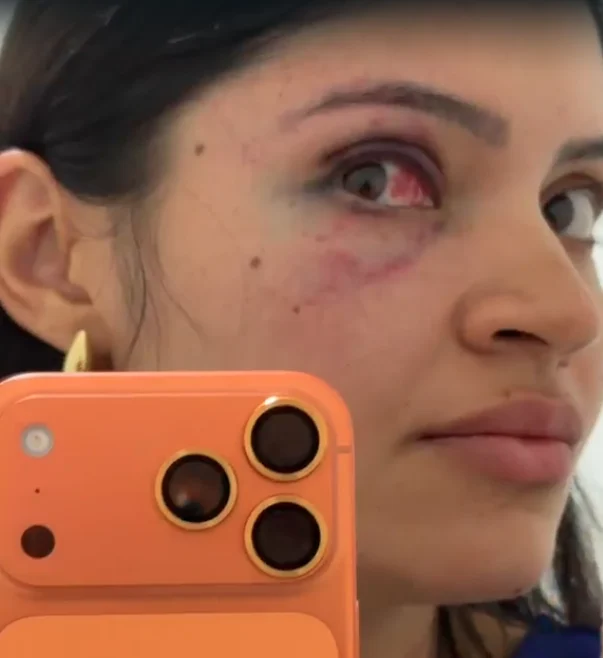Servidor preso por agredir esposa em Parnamirim é solto após audiência de custódia