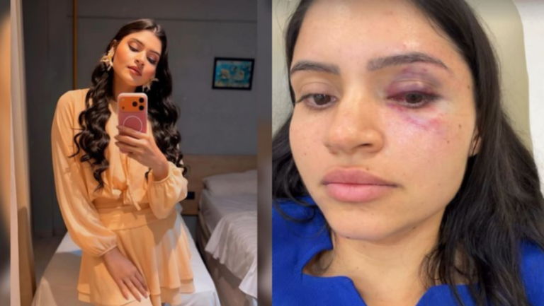 Técnica de enfermagem é enforcada e agredida pelo marido em Parnamirim